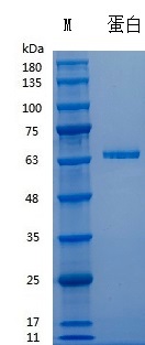 Y01301 Recombinant Human Fibronectin..jpg