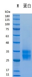 Y03801 Recombinant Human SCF.jpg