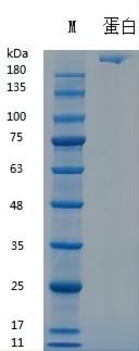 Y01344 Recombinant Human Fibronectin.jpg