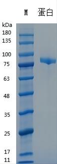 Y04501 Recombinant Human Transferrin(HOLO).jpg