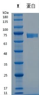 Y04603 Recombinant Human Wnt-3a(hFc Tag).jpg