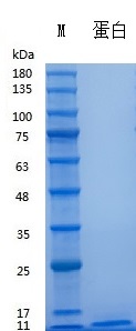 Y00801 Recombinant Human  EGF.jpg