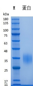 Y05801 Recombinant Human EPO.jpg