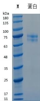 Y04841L Recombinant Human Vitronectin.jpg