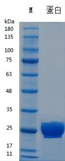 Y04702 Recombinant Human VEGF165(His Tag）.jpg