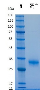 H003D/H003L Recombinant Human Noggin